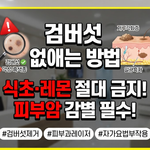 검버섯 없애는 방법