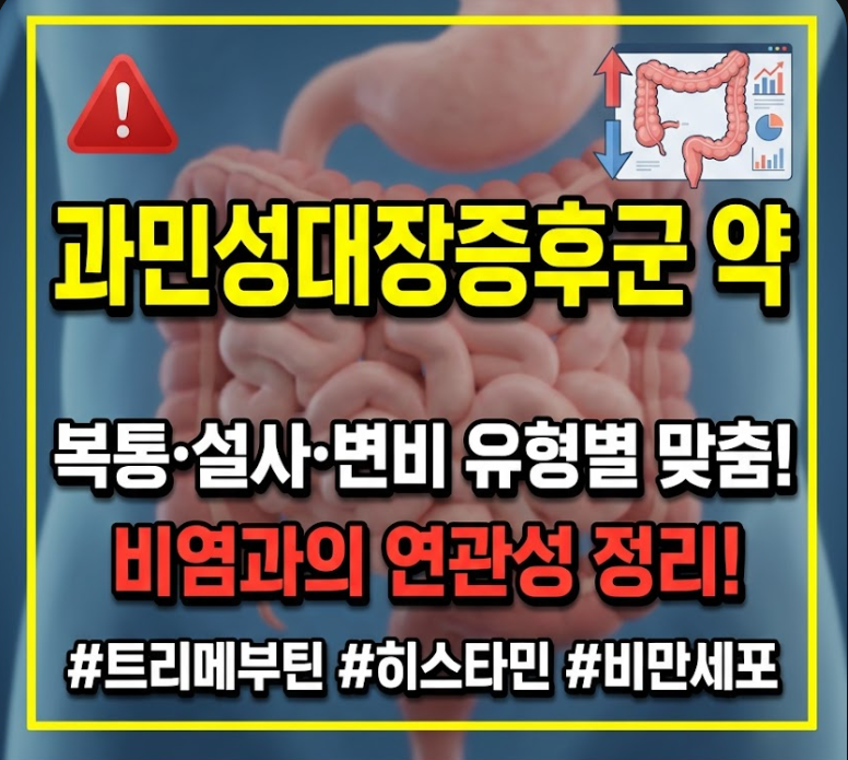 과민성대장증후군 약