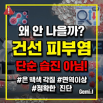 건선 피부염
