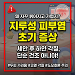 지루성 피부염 초기 증상