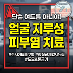 얼굴 지루성 피부염 치료