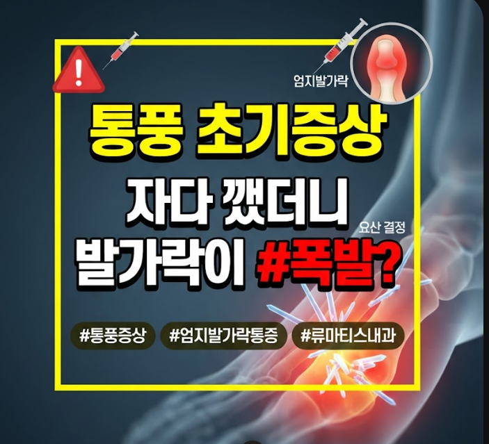 통풍 초기증상