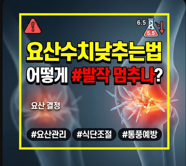 요산 수치 낮추는법